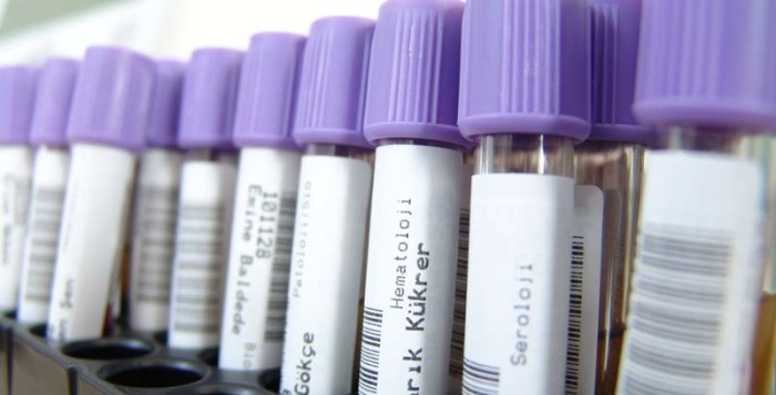 La Procreazione Medicalmente Assistita di Tipo Eterologo: un diritto a carico del servizio sanitario pubblico?